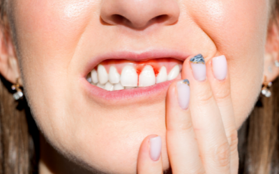 Dentista en Alcorcón: 3 hábitos para evitar enfermedades periodontales