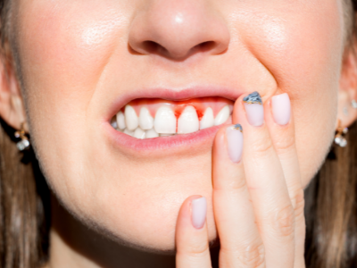 Dentista en Alcorcón: 3 hábitos para evitar enfermedades periodontales