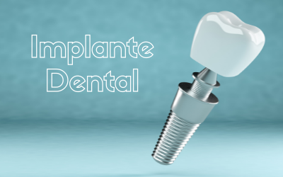 Dentista en Alcorcón: Implantes Dentales