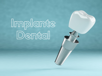 Dentista en Alcorcón: Implantes Dentales