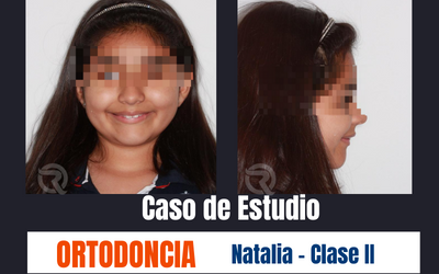 Ortodoncia – 1er Caso Natalia
