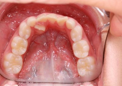 Ortodoncia. Dentista en Alcorcón.
