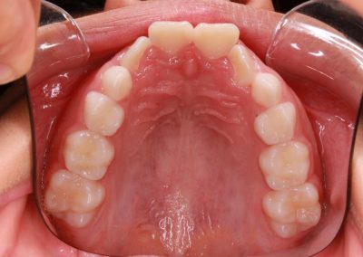 Ortodoncia. Dentista en Alcorcón.