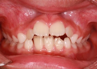 Ortodoncia. Dentista en Alcorcón.