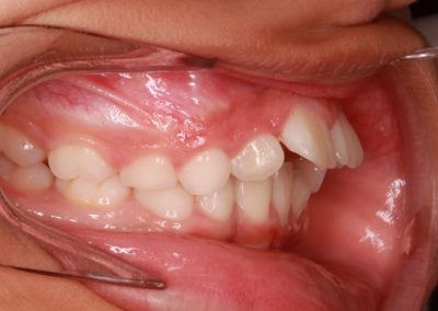 Ortodoncia. Dentista en Alcorcón.