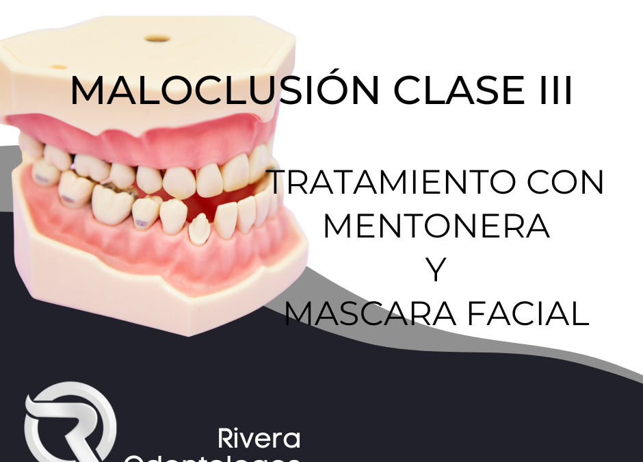 Dentista en Alcorcón: Maloclusión Tipo III – Mentonera y Máscara Facial