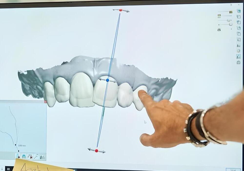 detalle de modelo dental en pantalla de computadora en laboratorio dental o clinica