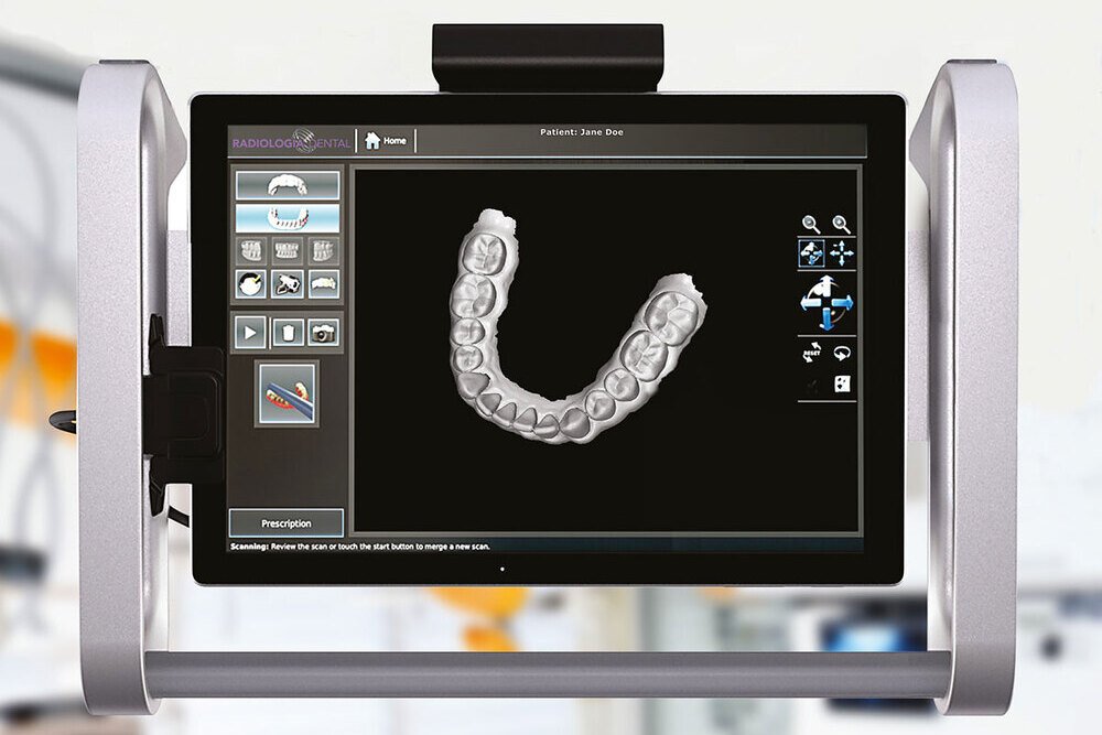 escaner intraoral 3d