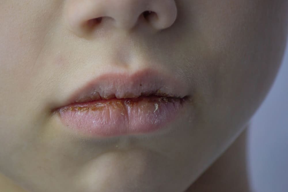 diagnostico y exploracion de falta de saliva en pacientes adultos